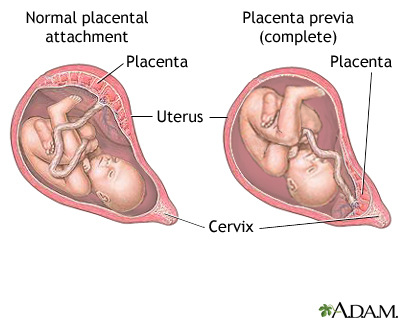 baby low in uterus