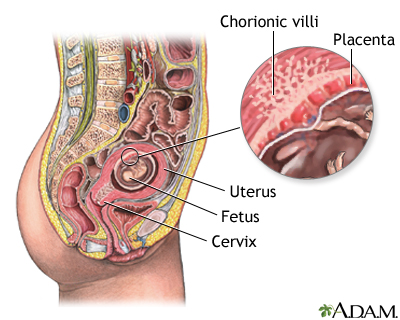 Chorionic Villus Sampling