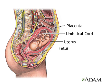 Percutaneous Umbilical Cord Blood Sampling