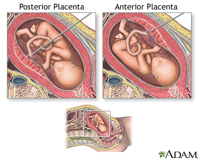 Percutaneous Umbilical Cord Blood Sampling