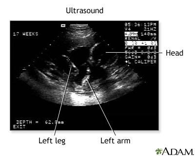 Ultrasound