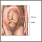 C-Section - series
